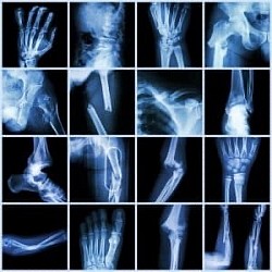 X-ray