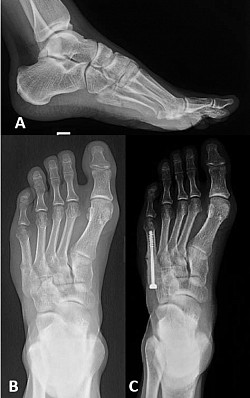 X-ray