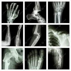 X-ray