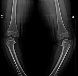 X-ray