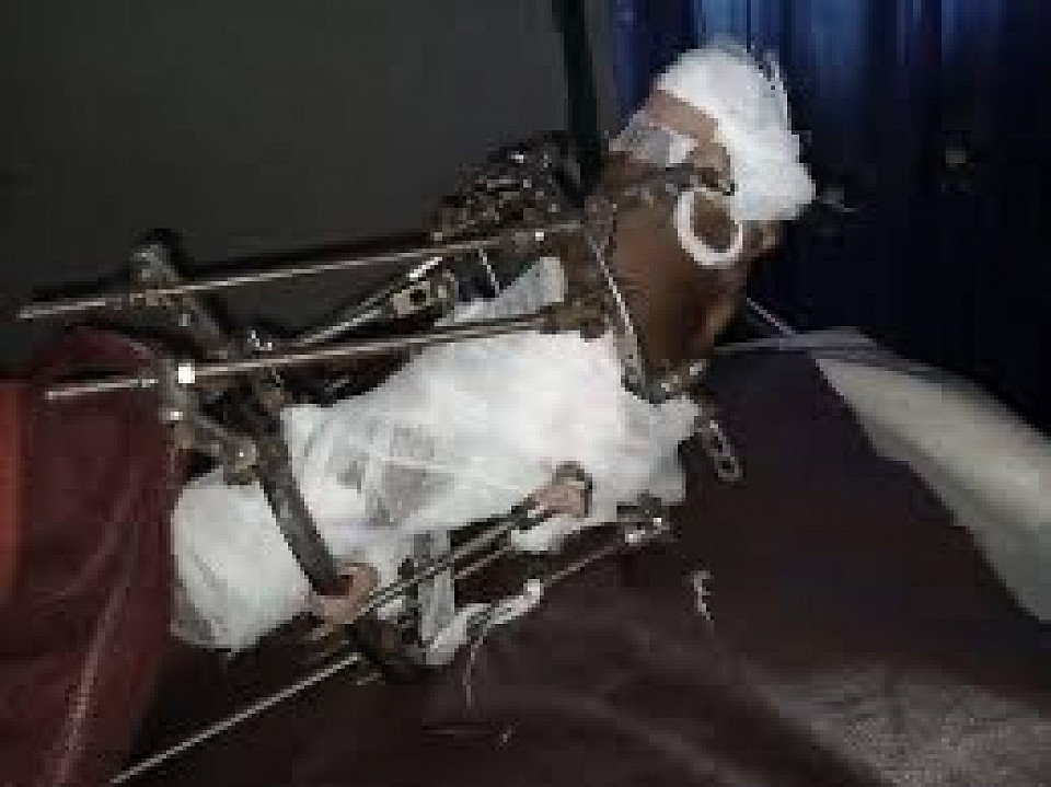 We fix it. No more amputation
